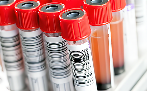 RFID�������ǻ��t��ѪҺ����